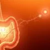 How gut health affects skin health