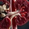 probiotic on kidney health