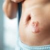 What are the signs of a bad colon?