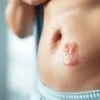 What are the signs of a bad colon?