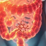 What does hydrogen water do to the gut?