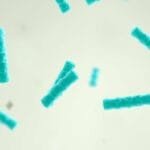 What probiotics do gynecologists recommend?